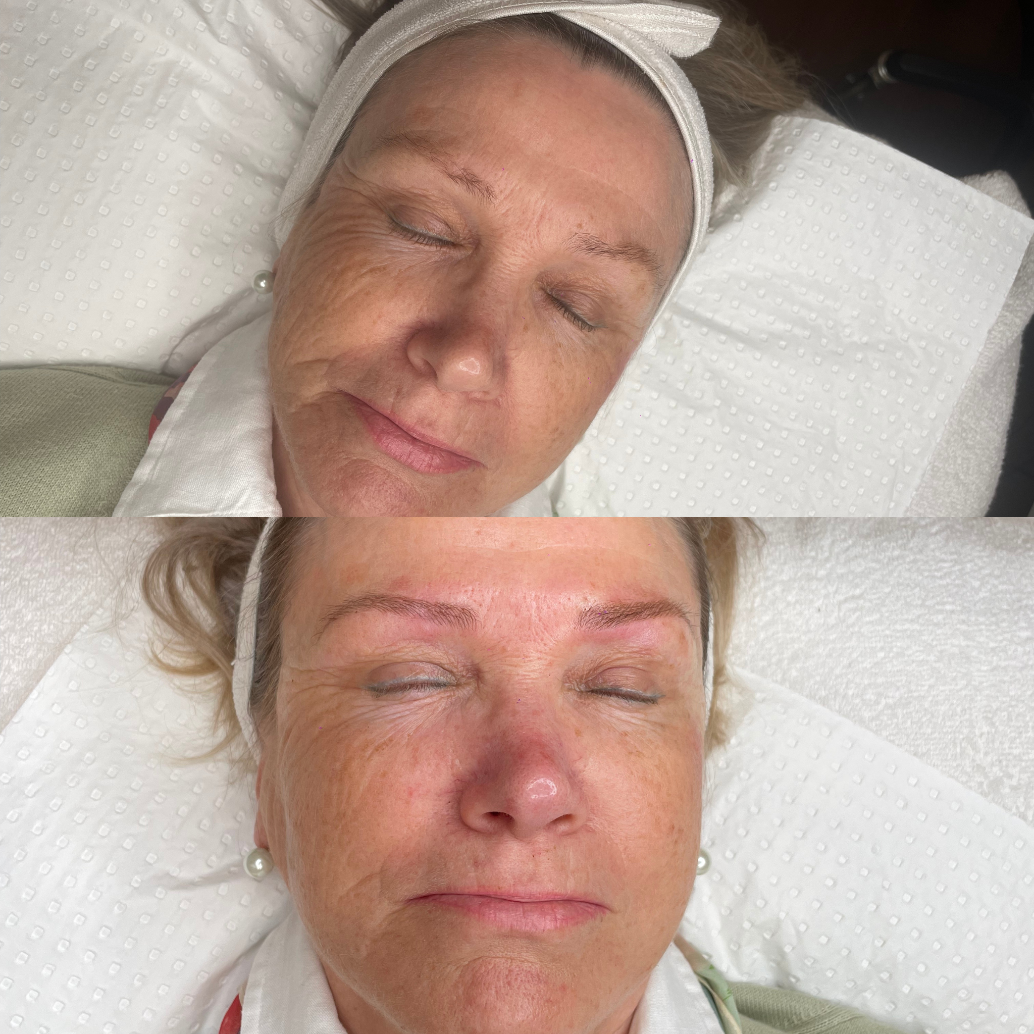 Before and after results of eyebrow microblading at Amavi Beauty Lounge in Brisbane, showing natural, hair-stroke brows.