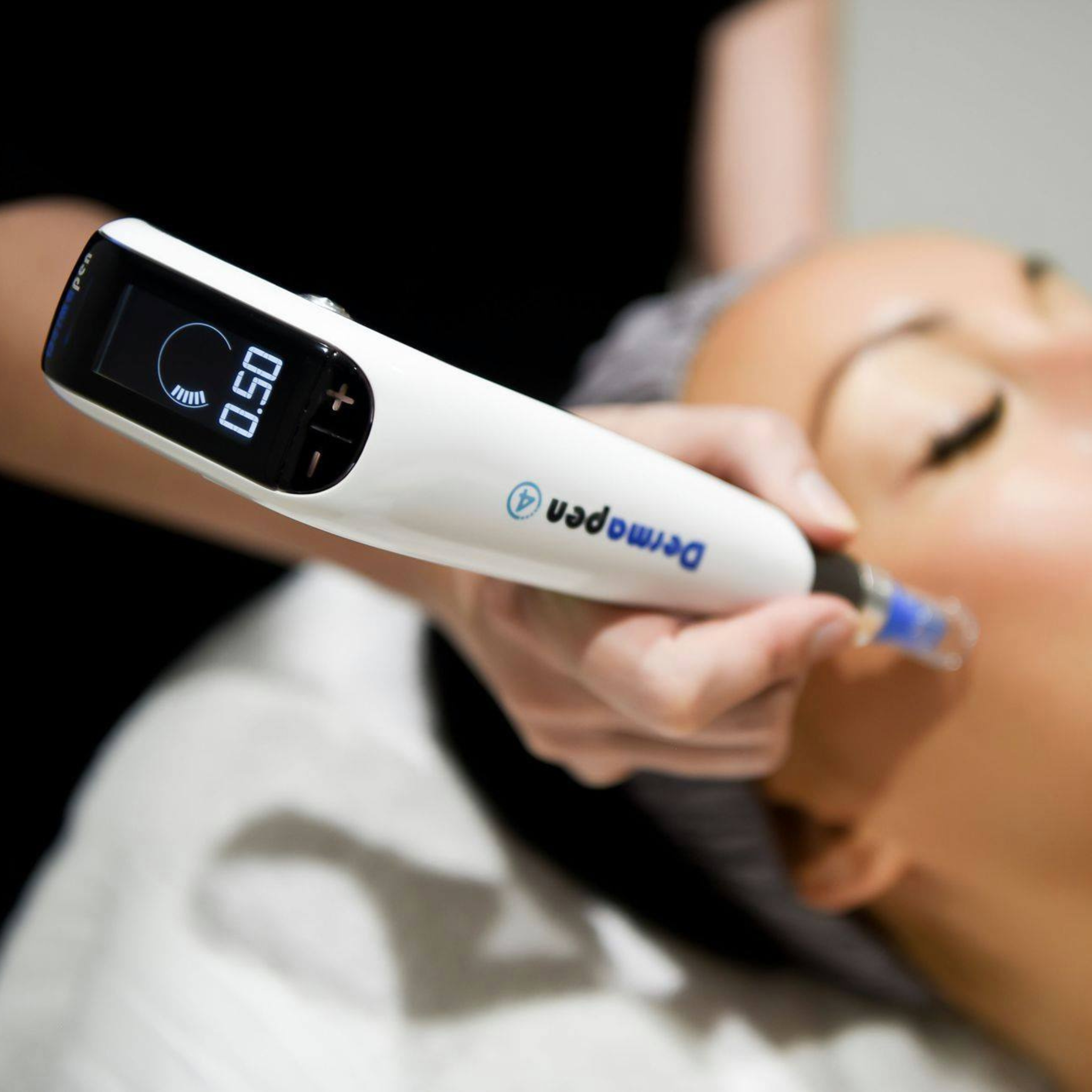 Everything You Need To Know About Microneedling A Revolutionary Skin