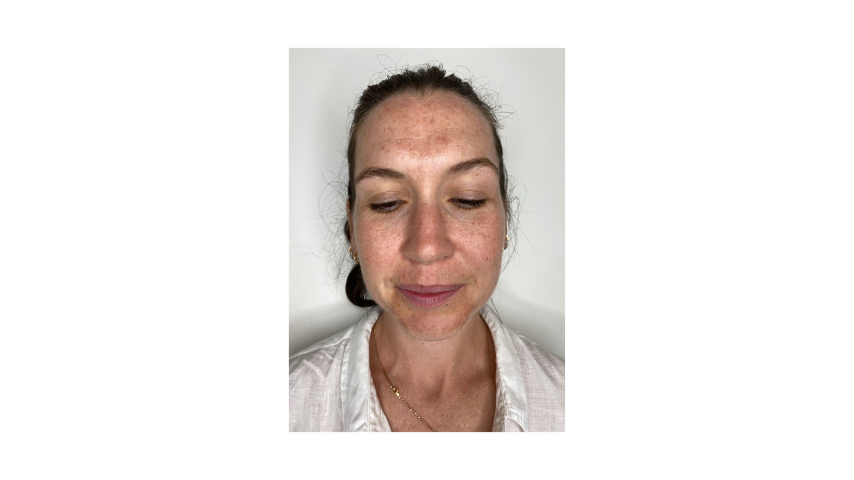 Skin Rejuvenation Program | Amavi Beauty Lounge Brisbane – Amavibeauty