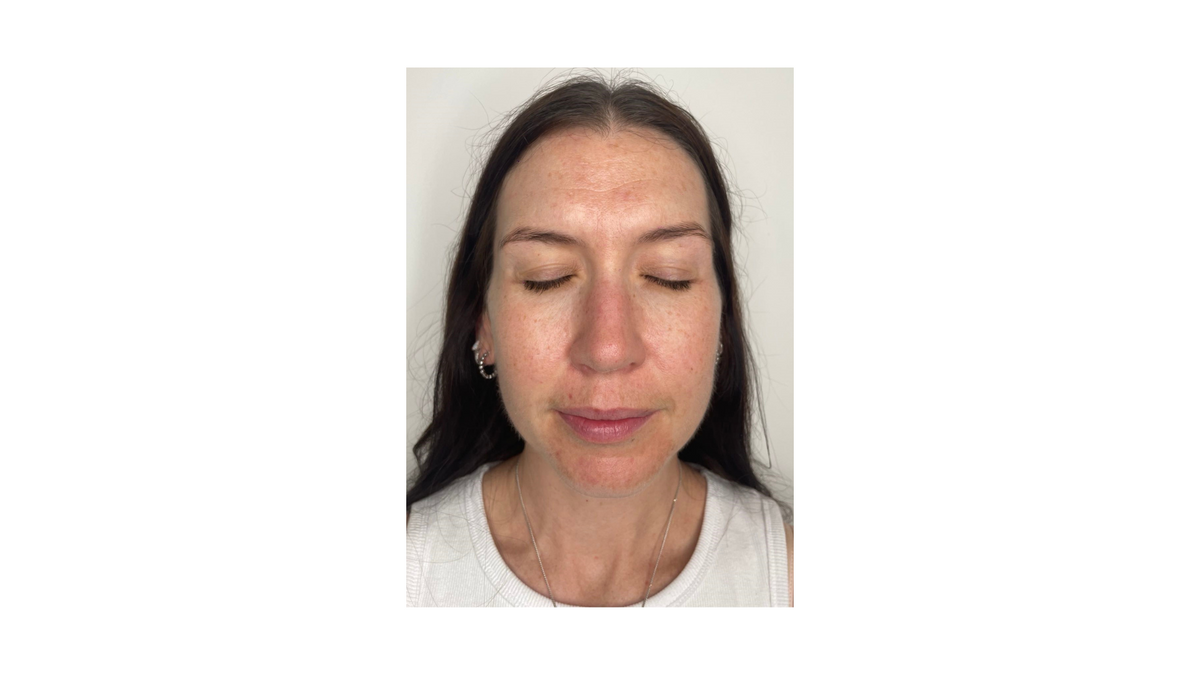 Skin Rejuvenation Program | Amavi Beauty Lounge Brisbane – Amavibeauty