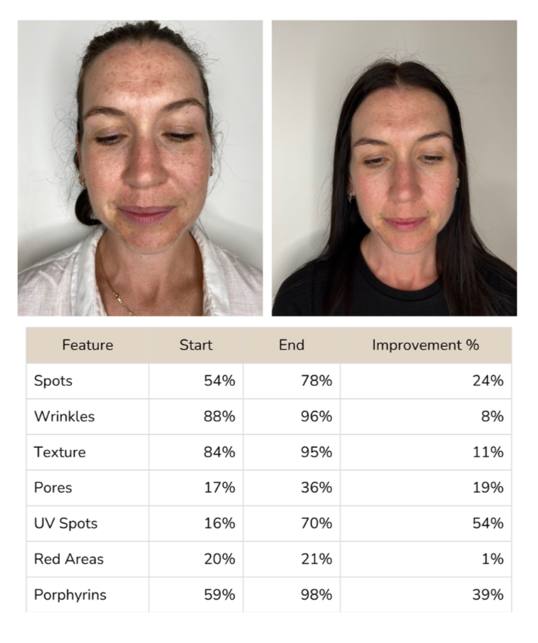 Skin Rejuvenation Program | Amavi Beauty Lounge Brisbane – Amavibeauty