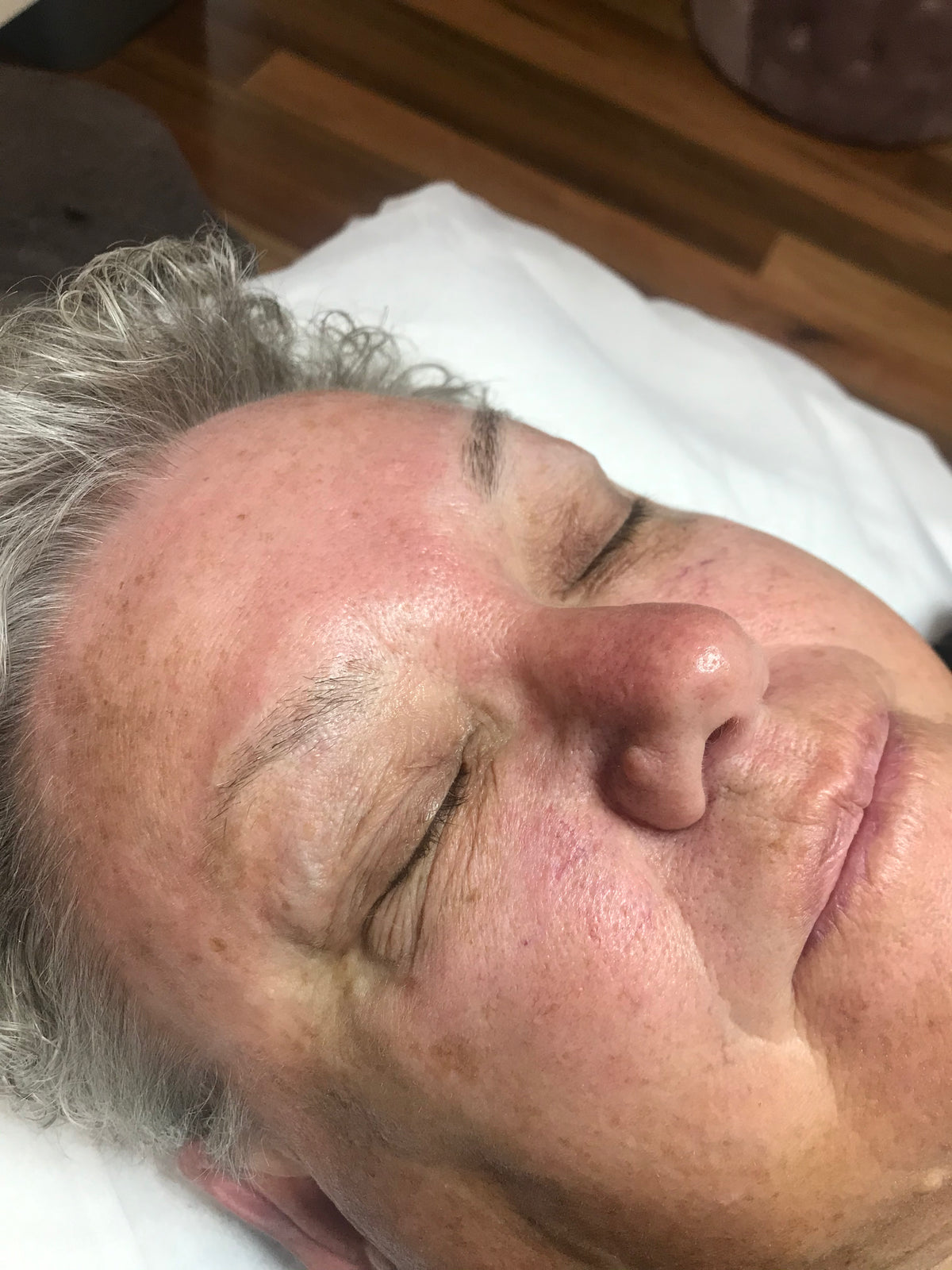 Mature client's brow area before cosmetic tattooing, with pale, thinning brows