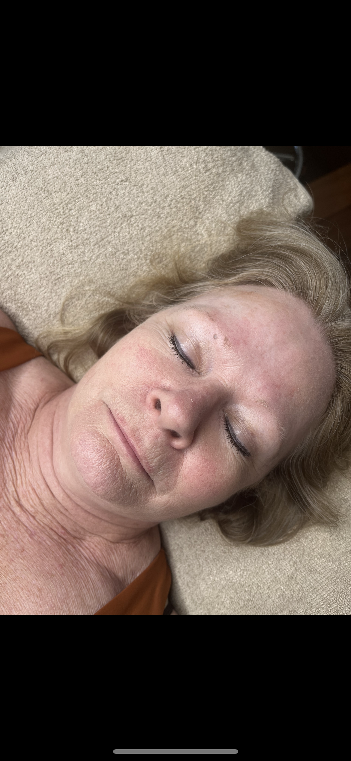 Close-up of a client's face before microblading, showing sparse, pale eyebrows