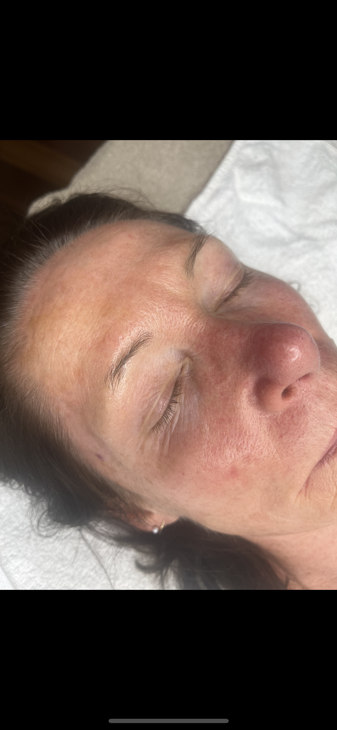 Client's brow area before cosmetic tattooing, showing fine, sparse brow hair