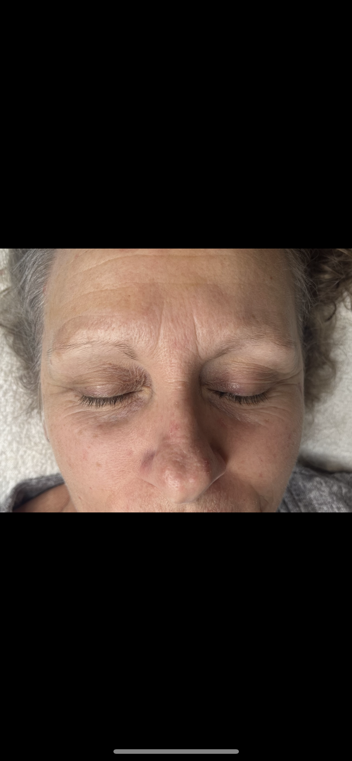 Close-up of grey, sparse eyebrows before microblading treatment